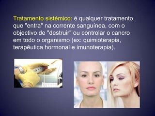 Tratamento sistémico: é qualquer tratamento
que "entra" na corrente sanguínea, com o
objectivo de "destruir" ou controlar o cancro
em todo o organismo (ex: quimioterapia,
terapêutica hormonal e imunoterapia).
 