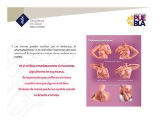 Las mamas pueden cambiar con el embarazo, el
amamantamiento o en diferentes momentos del ciclo
menstrual. Es importante conocer cómo cambian en tu
cuerpo.
Veal médicoinmediatamentesi encuentras
algo diferente entus mamas.
Esimportanteque confíesenti misma
cuando creasque algo noestábien.
El cáncerdemama puede sercurable cuando
sedetectaa tiempo.
 