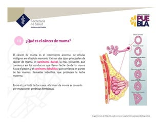 III
El cáncer de mama es el crecimiento anormal de células
malignas en el tejido mamario. Existen dos tipos principales de
cáncer de mama: el carcinoma ductal, la más frecuente, que
comienza en los conductos que llevan leche desde la mama
hasta el pezón, y el carcinoma lobulillar, que comienza en partes
de las mamas, llamadas lobulillos, que producen la leche
materna.
Entre el 5 al 10% de los casos, el cáncer de mama es causado
por mutaciones genéticas heredadas.
¿Quéeselcáncerdemama?
Imagen tomada de https://www.breastcancer.org/es/sintomas/tipos/cdis/diagnostico
 