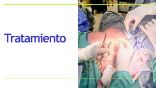 Tratamiento
 