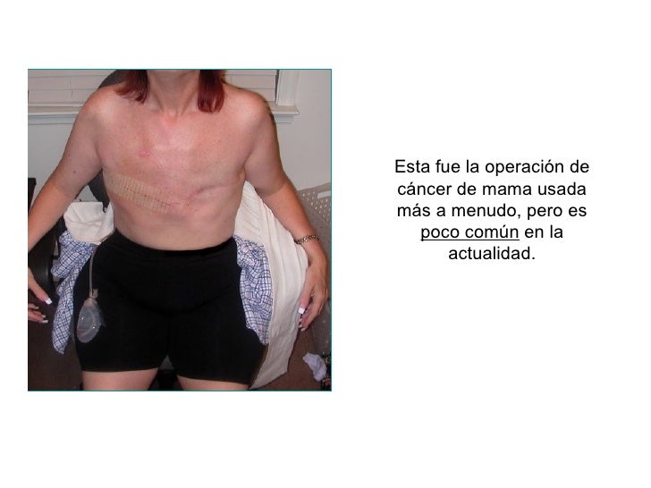 El medio para el aumento del pecho de taylanda