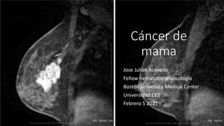 Cáncer de
mama
Jose Julian Acevedo
Fellow hematología/oncología
Boston University Medical Center
Universidad CES
Febrero 5 2021
 