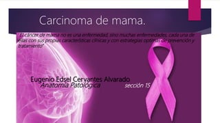 Eugenio Edsel Cervantes Alvarado
Anatomía Patológica sección 15
Carcinoma de mama.
“El cáncer de mama no es una enfermedad, sino muchas enfermedades, cada una de
ellas con sus propias características clínicas y con estrategias optimas de prevención y
tratamiento”
 