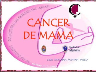 CANCER
DE MAMA

   GISEL THATIANA HUAYNA P ILCO
 