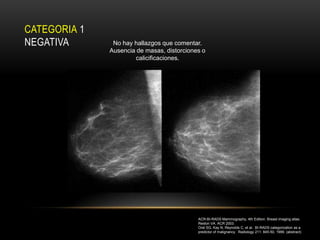 CATEGORIA 1
NEGATIVA       No hay hallazgos que comentar.
              Ausencia de masas, distorciones o
                      calicificaciones.




                                            ACR-BI-RADS Mammography, 4th Edition. Breast imaging atlas.
                                            Reston VA. ACR 2003.
                                            Orel SG, Kay N, Reynolds C, et al. BI-RADS categorization as a
                                            predictor of malignancy. Radiology 211: 845-50, 1999. (abstract)
 