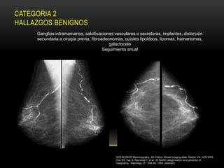 CATEGORIA 2
HALLAZGOS BENIGNOS
     Ganglios intramamarios, calcificaciones vasculares o secretoras, implantes, distorción
     secundaria a cirugía previa, fibroadeonomas, quistes lipoideos, lipomas, hamartomas,
                                           galactocele
                                        Seguimiento anual




                                              ACR-BI-RADS Mammography, 4th Edition. Breast imaging atlas. Reston VA. ACR 2003.
                                              Orel SG, Kay N, Reynolds C, et al. BI-RADS categorization as a predictor of
                                              malignancy. Radiology 211: 845-50, 1999. (abstract)
 