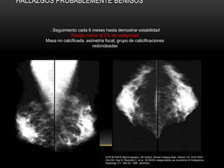 HALLAZGOS PROBABLEMENTE BENIGOS


        . Seguimiento cada 6 meses hasta demostrar estabilidad
                   Riesgo menor al 2% de malignidad
       Masa no calcificada, asimetria focal, grupo de calicificaciones
                               redondeadas




                                      ACR-BI-RADS Mammography, 4th Edition. Breast imaging atlas. Reston VA. ACR 2003.
                                      Orel SG, Kay N, Reynolds C, et al. BI-RADS categorization as a predictor of malignancy.
                                      Radiology 211: 845-50, 1999. (abstract)
 