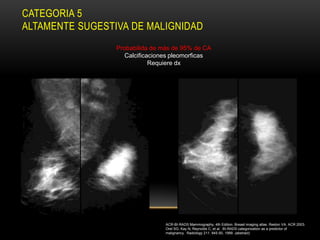 CATEGORIA 5
ALTAMENTE SUGESTIVA DE MALIGNIDAD
                 Probabilida de más de 95% de CA
                    Calcificaciones pleomorficas
                             Requiere dx




                                 ACR-BI-RADS Mammography, 4th Edition. Breast imaging atlas. Reston VA. ACR 2003.
                                 Orel SG, Kay N, Reynolds C, et al. BI-RADS categorization as a predictor of
                                 malignancy. Radiology 211: 845-50, 1999. (abstract)
 
