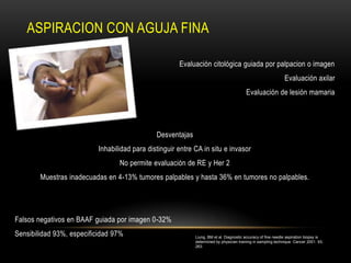 ASPIRACION CON AGUJA FINA

                                                       Evaluación citológica guiada por palpacion o imagen
                                                                                                               Evaluación axilar
                                                                                         Evaluación de lesión mamaria




                                               Desventajas
                           Inhabilidad para distinguir entre CA in situ e invasor
                                  No permite evaluación de RE y Her 2
        Muestras inadecuadas en 4-13% tumores palpables y hasta 36% en tumores no palpables.




Falsos negativos en BAAF guiada por imagen 0-32%
Sensibilidad 93%, especificidad 97%                          Liung, BM et al. Diagnostic accuracy of fine needle aspiration biopsy is
                                                             determined by physician training in sampling technique. Cancer 2001. 93;
                                                             263.
 