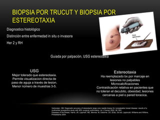 BIOPSIA POR TRUCUT Y BIOPSIA POR
   ESTEREOTAXIA
Diagnostico histológico
Distinción entre enfermedad in situ o invasora
Her 2 y RH


                               Guiada por palpación, USG estereotaxia


                USG                                                                                          Estereotaxia
   Mejor tolerado que estereotaxia.                                                        Ha reemplazado bx por marcaje en
    Permite visualizacion directa de                                                              lesiones no palpables
   paso de aguja a través de lesion.                                                               Microcalcificaciones
   Menor número de muestras 3-5.                                                        Contraidicación relativa en pacientes que
                                                                                        no toleran el decubito, obesidad, lesiones
                                                                                             cercanas a piel o pared toracica.



                                Verkooijen, HM. Diagnostic accuracy of stereotactic large core needle biopsy for nonpalpable bresat disease: results of a
                                multicenter prospective study with 95% surgical confirmation. Int J Cancer 2002; 99: 853.
                                Diseases of the Breast, Harris, JR, Lippman, ME, Morrow, M, Osborne, CK, (Eds), 3rd ed, Lippincott, Williams and Wilkins,
                                Philadelphia 2004.
 