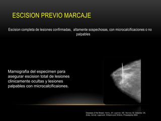 ESCISION PREVIO MARCAJE
Escision completa de lesiones confirmadas, altamente sospechosas, con microcalcificaciones o no
                                             palpables




Mamografia del especimen para
asegurar escision total de lesiones
clinicamente ocultas y lesiones
palpables con microcalcificaiones.




                                                   Diseases of the Breast, Harris, JR, Lippman, ME, Morrow, M, Osborne, CK,
                                                   (Eds), 3rd ed, Lippincott, Williams and Wilkins, Philadelphia 2004.
 