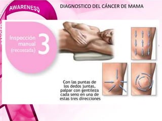 DIAGNOSTICO DEL CÁNCER DE MAMA
 