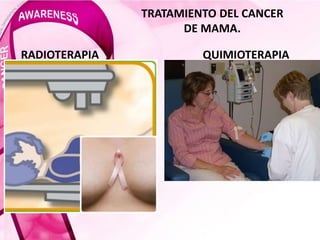 TRATAMIENTO DEL CANCER
DE MAMA.
RADIOTERAPIA QUIMIOTERAPIA
 