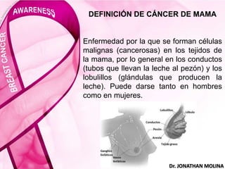 DEFINICIÓN DE CÁNCER DE MAMA
Enfermedad por la que se forman células
malignas (cancerosas) en los tejidos de
la mama, por lo general en los conductos
(tubos que llevan la leche al pezón) y los
lobulillos (glándulas que producen la
leche). Puede darse tanto en hombres
como en mujeres.
Dr. JONATHAN MOLINA
 