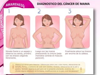 DIAGNOSTICO DEL CÁNCER DE MAMA
 