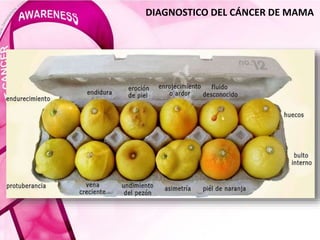DIAGNOSTICO DEL CÁNCER DE MAMA
 