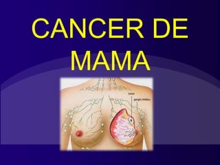 CANCER DE
MAMA
 