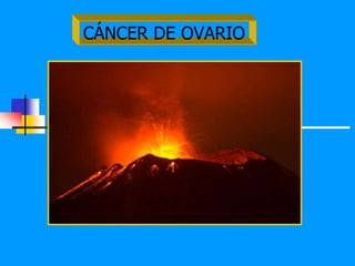 CÁNCER DE OVARIO
 