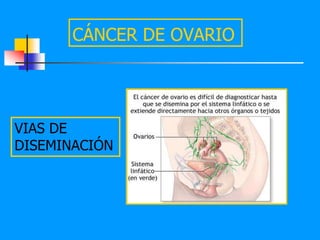 CÁNCER DE OVARIO




VIAS DE
DISEMINACIÓN
 