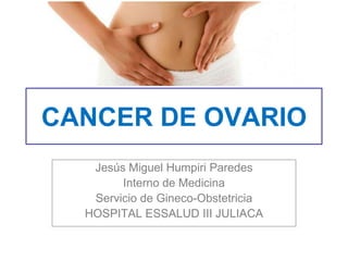 CANCER DE OVARIO
Jesús Miguel Humpiri Paredes
Interno de Medicina
Servicio de Gineco-Obstetricia
HOSPITAL ESSALUD III JULIACA
 