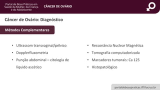 portaldeboaspraticas.iff.fiocruz.br
CÂNCER DE OVÁRIO
Câncer de Ovário: Diagnóstico
• Ultrassom transvaginal/pélvico
• Dopplerfluxometria
• Punção abdominal – citologia de
líquido ascético
• Ressonância Nuclear Magnética
• Tomografia computadorizada
• Marcadores tumorais: Ca 125
• Histopatológico
Métodos Complementares
 