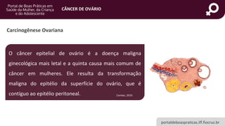 portaldeboaspraticas.iff.fiocruz.br
CÂNCER DE OVÁRIO
Carcinogênese Ovariana
O câncer epitelial de ovário é a doença maligna
ginecológica mais letal e a quinta causa mais comum de
câncer em mulheres. Ele resulta da transformação
maligna do epitélio da superfície do ovário, que é
contíguo ao epitélio peritoneal. Conitec, 2019.
 