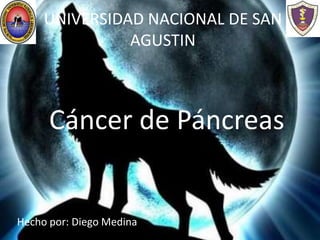 UNIVERSIDAD NACIONAL DE SAN
               AGUSTIN



      Cáncer de Páncreas


Hecho por: Diego Medina
 