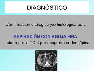 DIAGNÓSTICO
Confirmación citológica y/o histológica por:
ASPIRACIÓN CON AGUJA FINA
guiada por la TC o por ecografía endoscópica
 