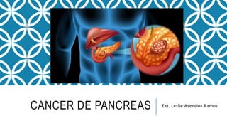 CANCER DE PANCREAS Ext. Leslie Asencios Ramos
 