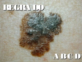 A BC DA BC D
REGRAREGRA DODO
 