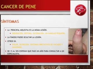 • LA PRINCIPAL MOLESTIA ES LA MISMA LESIÓN.
• INDURACIÓN, ERITEMA, ULCERACIÓN, UN GANGLIO PEQUEÑO.
• LA FIMOSIS PUEDE OCULTAR LA LESIÓN.
• OTROS SX.
• DOLOR, SECRECIÓN, SÍNTOMAS IRRITATIVOS DE VACIADO Y
SANGRADO.
• DE 15 AL 50% ESPERAN QUE PASE UN AÑO PARA CONSULTAR A UN
ESPECIALISTA.
CANCER DE PENE
 