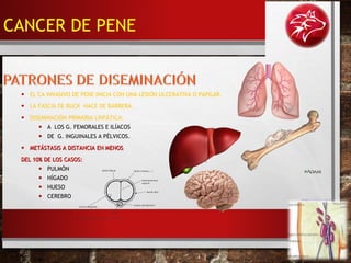 • EL CA INVASIVO DE PENE INICIA CON UNA LESIÓN ULCERATIVA O PAPILAR.
• LA FASCIA DE BUCK HACE DE BARRERA.
• DISEMINACIÓN PRIMARIA LINFÁTICA:
• A LOS G. FEMORALES E ILÍACOS
• DE G. INGUINALES A PÉLVICOS.
• METÁSTASIS A DISTANCIA EN MENOSMETÁSTASIS A DISTANCIA EN MENOS
DEL 10% DE LOS CASOS:DEL 10% DE LOS CASOS:
• PULMÓN
• HÍGADO
• HUESO
• CEREBRO
CANCER DE PENE
 