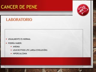 • USUALMENTE ES NORMAL
• PODRÍA HABER:
• ANEMIA
• LEUCOCITOSIS (PX LARGA EVOLUCIÓN)
• HIPERCALCEMIA
CANCER DE PENE
 
