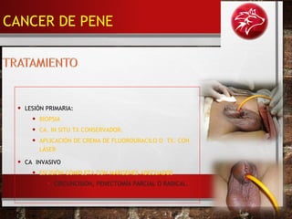 • LESIÓN PRIMARIA:
• BIOPSIA
• CA. IN SITU TX CONSERVADOR.
• APLICACIÓN DE CREMA DE FLUOROURACILO O TX. CON
LÁSER
• CA INVASIVO
• ESCISIÓN COMPLETA CON MÁRGENES ADECUADOS
• CIRCUNCISIÓN, PENECTOMÍA PARCIAL O RADICAL.
CANCER DE PENE
 