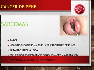 • RAROS
• HEMAGIOENDOTELIOMA ES EL MAS FRECUENTE DE ELLOS
• ALTA RECURRECIA LOCAL
• SON RARAS LAS METÁSTASIS GANGLIONARES Y A DISTANCIA
• RESPUESTA A RADIO Y QUIMIOTERAPIA
SARCOMAS
CANCER DE PENE
 