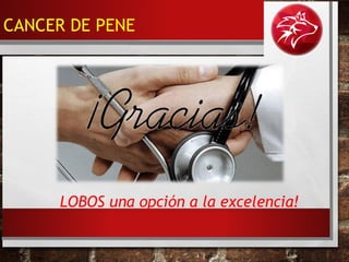 LOBOS una opción a la excelencia!
CANCER DE PENE
 