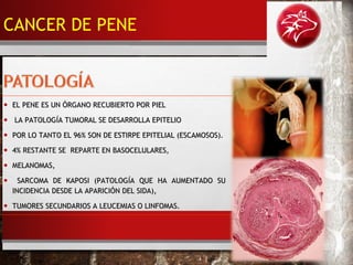 • EL PENE ES UN ÓRGANO RECUBIERTO POR PIELEL PENE ES UN ÓRGANO RECUBIERTO POR PIEL
• LA PATOLOGÍA TUMORAL SE DESARROLLA EPITELIOLA PATOLOGÍA TUMORAL SE DESARROLLA EPITELIO
• POR LO TANTO EL 96% SON DE ESTIRPE EPITELIAL (ESCAMOSOS).POR LO TANTO EL 96% SON DE ESTIRPE EPITELIAL (ESCAMOSOS).
• 4% RESTANTE SE REPARTE EN BASOCELULARES,4% RESTANTE SE REPARTE EN BASOCELULARES,
• MELANOMAS,MELANOMAS,
• SARCOMA DE KAPOSI (PATOLOGÍA QUE HA AUMENTADO SUSARCOMA DE KAPOSI (PATOLOGÍA QUE HA AUMENTADO SU
INCIDENCIA DESDE LA APARICIÓN DEL SIDA),INCIDENCIA DESDE LA APARICIÓN DEL SIDA),
• TUMORES SECUNDARIOS A LEUCEMIAS O LINFOMAS.TUMORES SECUNDARIOS A LEUCEMIAS O LINFOMAS.
CANCER DE PENE
 