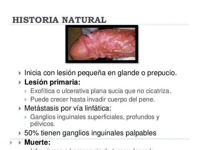 Los pequeños vástagos sobre el miembro