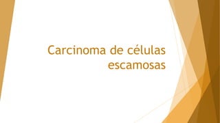 Carcinoma de células
escamosas
 