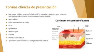 Formas clínicas de presentación
 Por masa, nódulo o pequeño bulto (47%): pápulas, pústulas, crecimientos
verrugosos más notorios o lesiones exofíticas floridas
 Dolor (35%)
 clínica inflamatoria (17%)
 Picor
 Quemazón
 Hemorragia
 Fístula
 Obstrucción uretral
 Síndrome constitucional y complicaciones tardías.
 