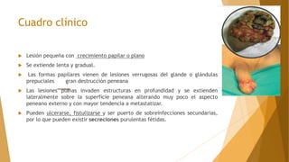 Cuadro clínico
 Lesión pequeña con crecimiento papilar o plano
 Se extiende lenta y gradual.
 Las formas papilares vienen de lesiones verrugosas del glande o glándulas
prepuciales gran destrucción peneana
 Las lesiones planas invaden estructuras en profundidad y se extienden
lateralmente sobre la superficie peneana alterando muy poco el aspecto
peneano externo y con mayor tendencia a metastatizar.
 Pueden ulcerarse, fistulizarse y ser puerto de sobreinfecciones secundarias,
por lo que pueden existir secreciones purulentas fétidas.
 
