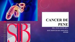 CANCER DE
PENE
DRA. ELBAAGUILAR L.
JEFE SERVICIO DE UROLOGIA
HNSEB
 