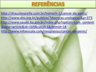 REFERÊNCIAS
http://drauziovarella.com.br/homem-2/cancer-de-penis/
http://www.sbu.org.br/publico/?doencas-urologicas&p=373
http://www.saude.ba.gov.br/index.php?option=com_content
&view=article&id=169&catid=3&Itemid=18
http://www.infoescola.com/neoplasias/cancer-de-penis/
 