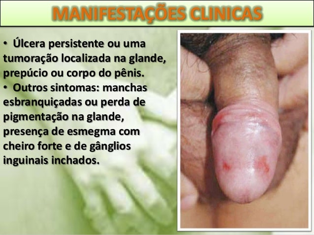 Como aumentar o membro da medicina para ela