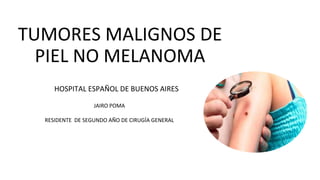 TUMORES MALIGNOS DE
PIEL NO MELANOMA
HOSPITAL ESPAÑOL DE BUENOS AIRES
JAIRO POMA
RESIDENTE DE SEGUNDO AÑO DE CIRUGÍA GENERAL
 