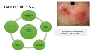 FACTORES DE RIESGO
QUERATOSIS
ACTÍNICA
Lesión precursora
ZONAS DE
INFLAMACIÓN
CRÓNICA
HUMO DE
TABACO
INFECCIONES
VIRALES (VPH)
HOMBRES 3:1
MUJERES
BRONCEADO >2.5
● La enfermedad de Bowen se
considera un CEC in situ
 