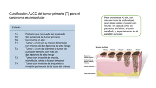 Clasificación AJCC del tumor primario (T) para el
carcinoma espinocelular Peor pronósticos >2 cm, con
más de 4 mm de profundidad,
gran atipia celular, invasión peri
neural, en cabeza como los
párpados, los labios, el cuero
cabelludo y, especialmente, en el
pabellón auricular.
 