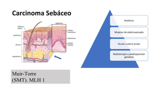Carcinoma Sebáceo
Asiaticos
Mujeres de edad avanzada
Ocular y extra ocular
Radioterapia y predisposición
genetica
Muir-Torre
(SMT). MLH 1
 