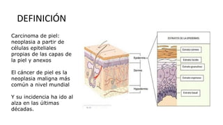 DEFINICIÓN
Carcinoma de piel:
neoplasia a partir de
células epiteliales
propias de las capas de
la piel y anexos
El cáncer de piel es la
neoplasia maligna más
común a nivel mundial
Y su incidencia ha ido al
alza en las últimas
décadas.
 