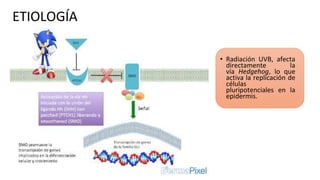 ETIOLOGÍA
• Radiación UVB, afecta
directamente la
vía Hedgehog, lo que
activa la replicación de
células
pluripotenciales en la
epidermis.
 